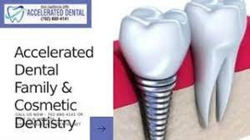 Best Dentist Near Me Las Vegas, Nv